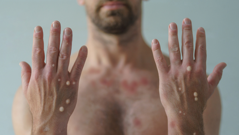 Uma imagem impressionante